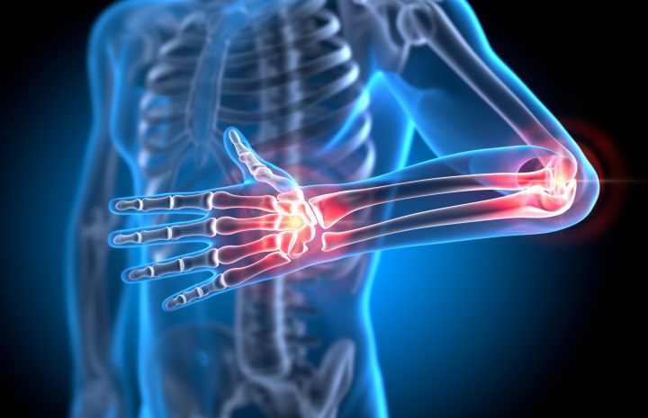 ¿Cómo la IA ayuda superar lesiones musculares?