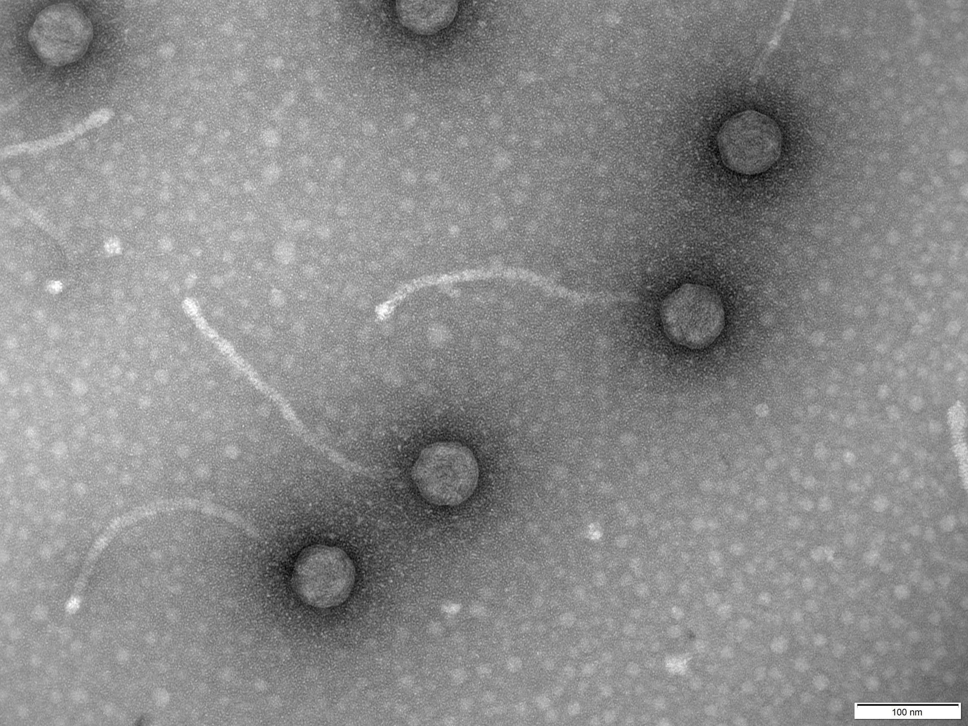 ¿Qué son los fagos, los «come» bacterias resistentes?