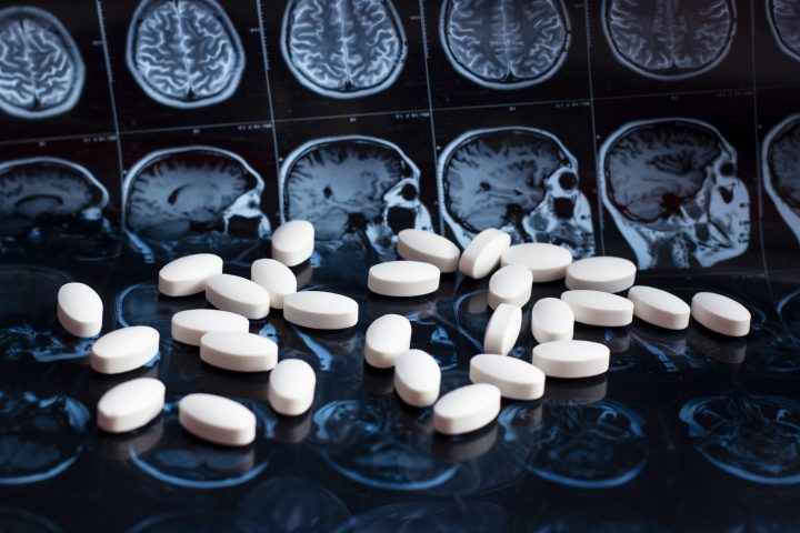 EE.UU. aprobó nuevo medicamento para tratar el Alzheimer